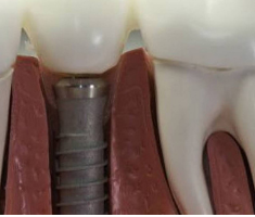 Slider image (2) Medident